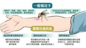 被毒蚊子咬了怎么办？蚊子咬了怎么消肿止痒