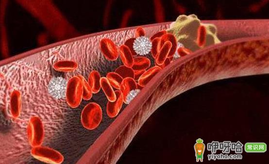 能软化血管的12种食物 让血管恢复正常